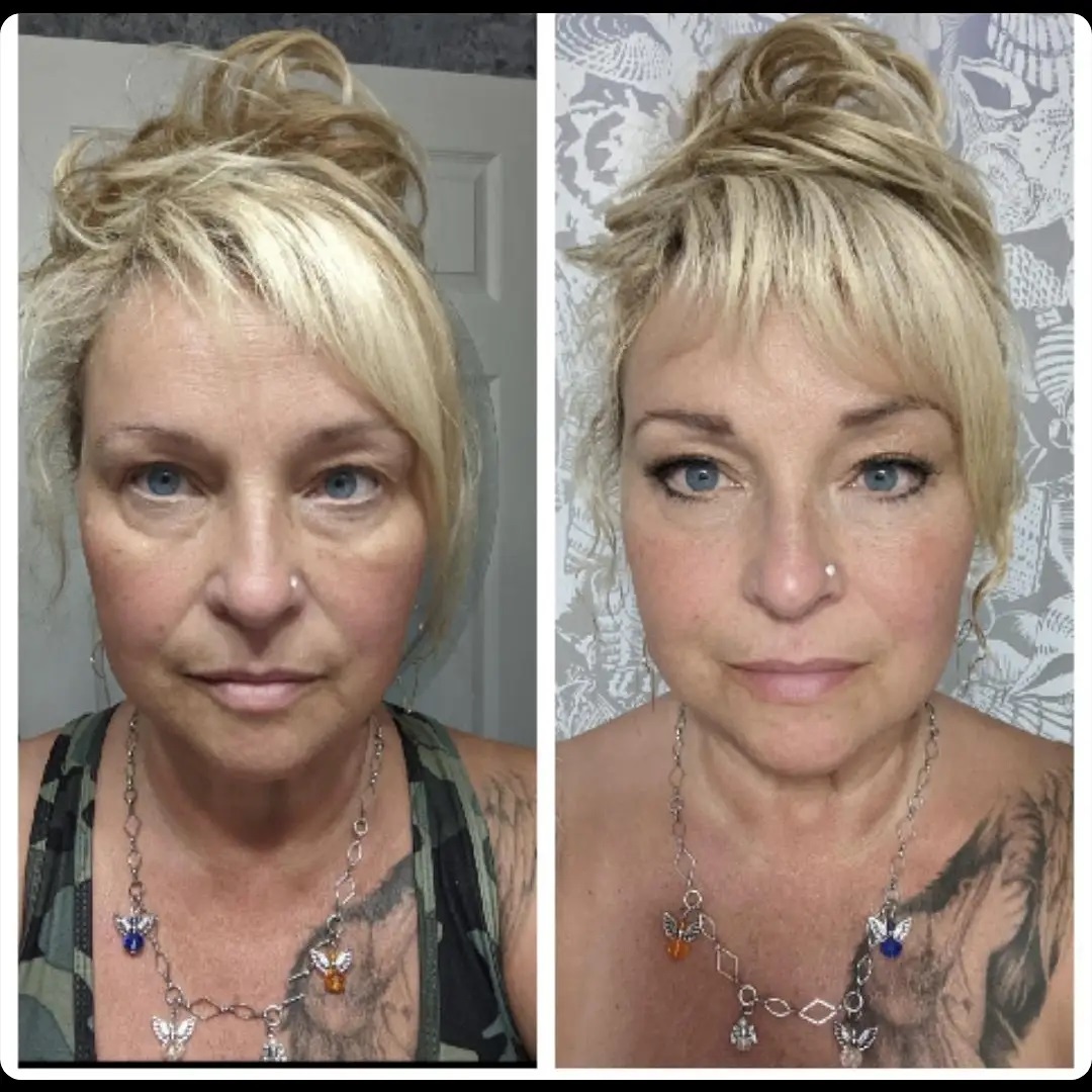 LipsByJoe before and after aesthetic transformation